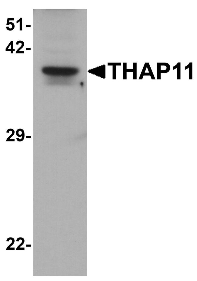 THAP11 Antibody in Western Blot (WB)