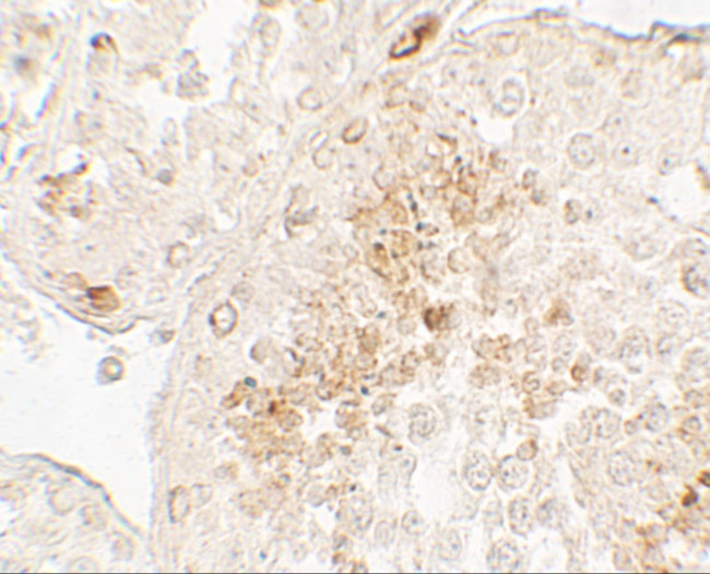 GLIPR1L1 Antibody in Immunohistochemistry (Paraffin) (IHC (P))