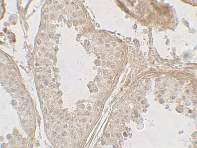 GLIPR1L2 Antibody in Immunohistochemistry (Paraffin) (IHC (P))
