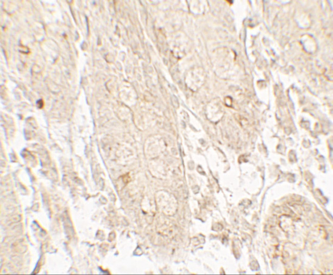 GRK6 Antibody in Immunohistochemistry (Paraffin) (IHC (P))