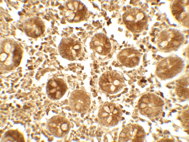 APOBEC3B Antibody in Immunohistochemistry (Paraffin) (IHC (P))