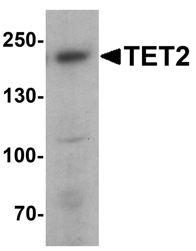 TET2 Antibody in Western Blot (WB)