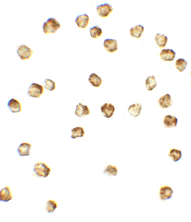 MIB1 Antibody in Immunocytochemistry (ICC/IF)