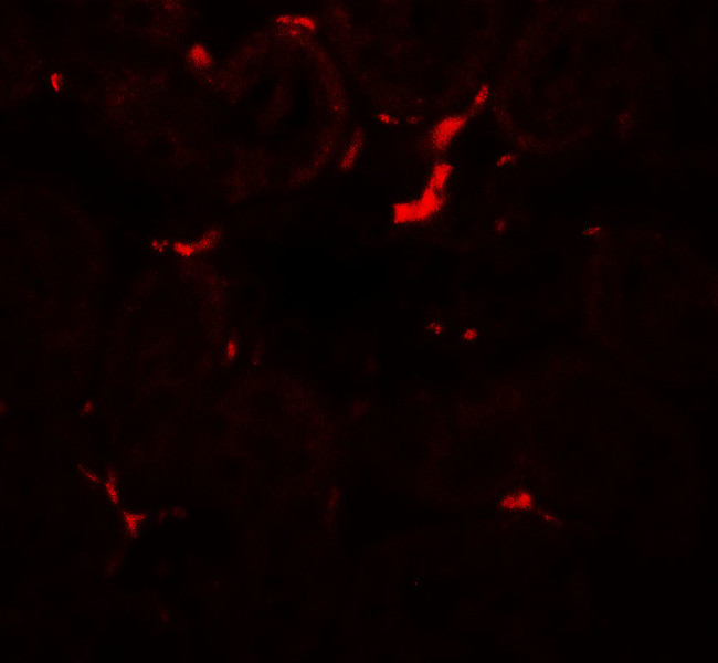 Vezatin Antibody in Immunohistochemistry (Paraffin) (IHC (P))