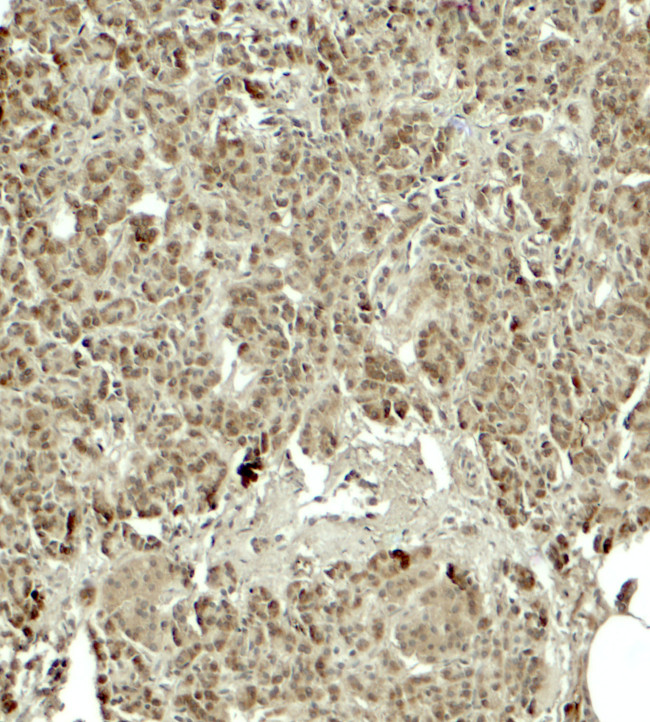 KIRREL2 Antibody in Immunohistochemistry (Paraffin) (IHC (P))