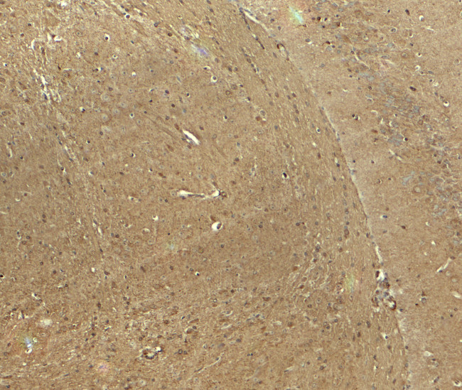 CADM3 Antibody in Immunohistochemistry (Paraffin) (IHC (P))