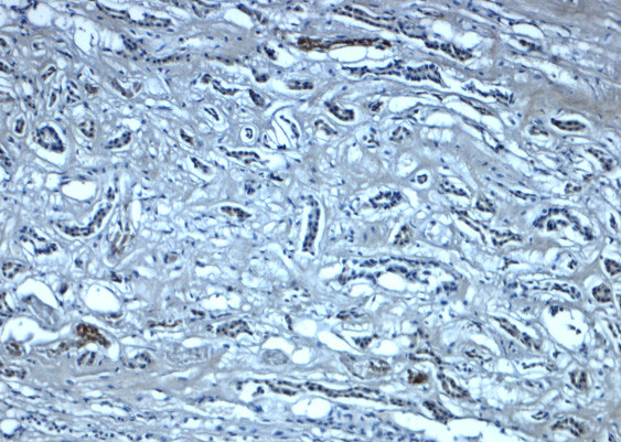 Nephrin Antibody in Immunohistochemistry (Paraffin) (IHC (P))