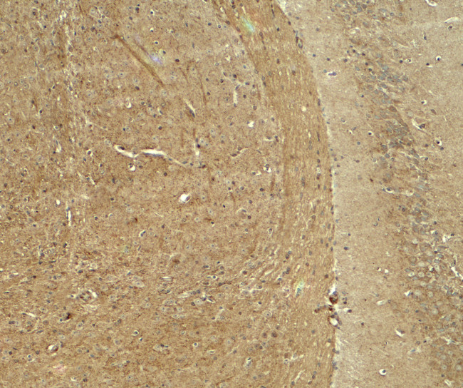 WDR61 Antibody in Immunohistochemistry (Paraffin) (IHC (P))