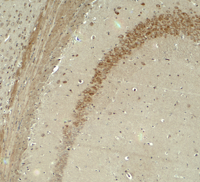 IQSEC2 Antibody in Immunohistochemistry (Paraffin) (IHC (P))
