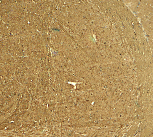 STEP Antibody in Immunohistochemistry (Paraffin) (IHC (P))