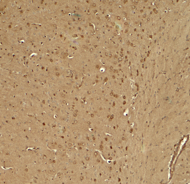 KCNK1 Antibody in Immunohistochemistry (Paraffin) (IHC (P))