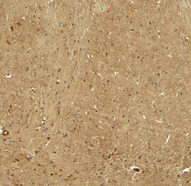 RHOT1 Antibody in Immunohistochemistry (Paraffin) (IHC (P))