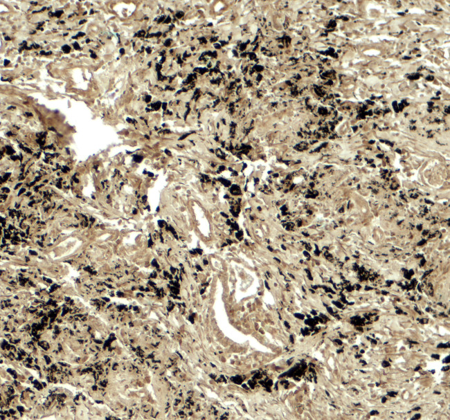 PPM1D Antibody in Immunohistochemistry (Paraffin) (IHC (P))