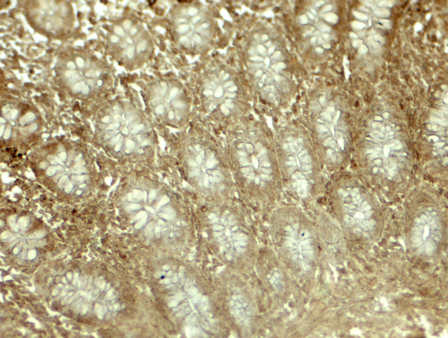 EPLIN Antibody in Immunohistochemistry (Paraffin) (IHC (P))