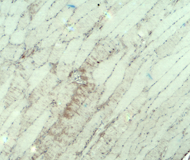 MYH3 Antibody in Immunohistochemistry (Paraffin) (IHC (P))