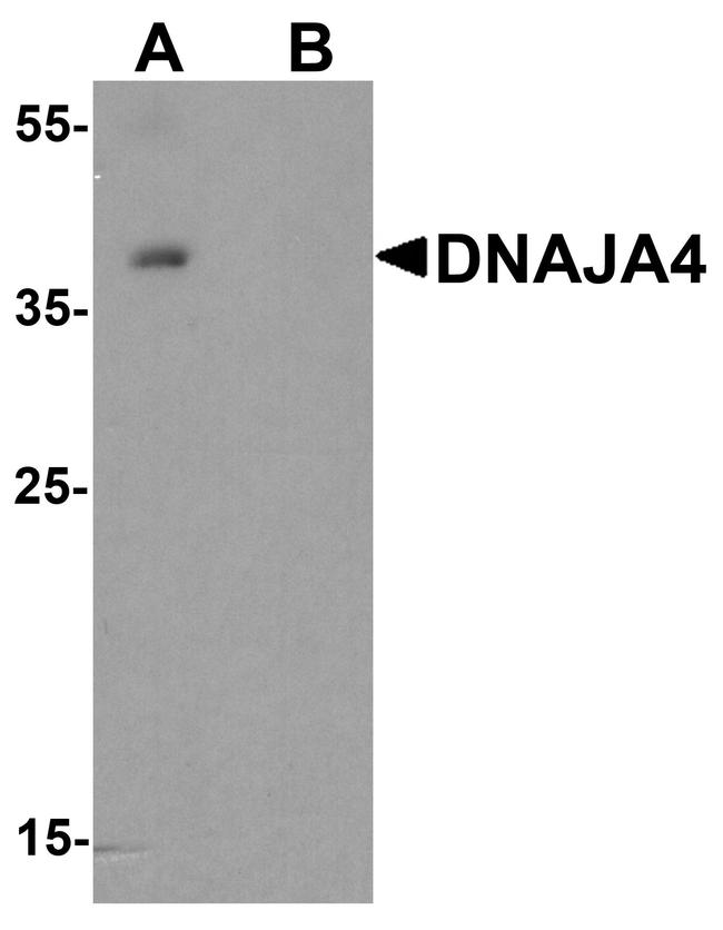 DNAJA4 Antibody in Western Blot (WB)