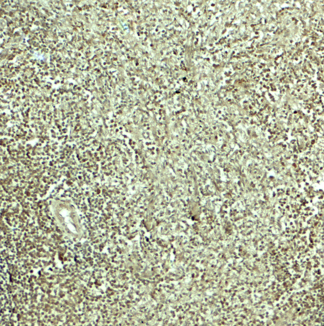 SNRPN Antibody in Immunohistochemistry (Paraffin) (IHC (P))