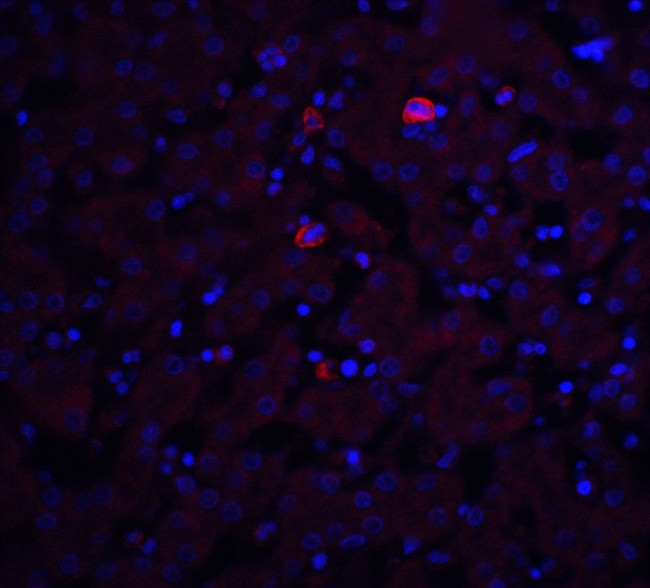 TRO Antibody in Immunohistochemistry (Paraffin) (IHC (P))