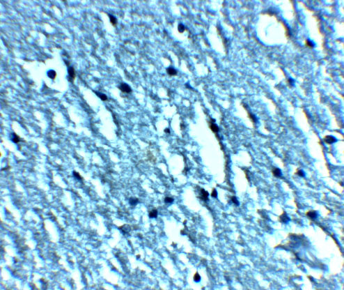 TRPC3 Antibody in Immunohistochemistry (Paraffin) (IHC (P))