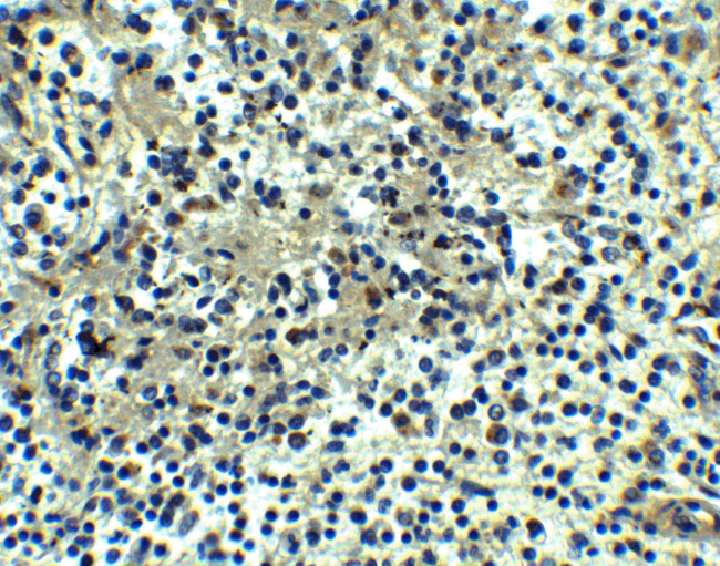 DEPDC1B Antibody in Immunohistochemistry (Paraffin) (IHC (P))
