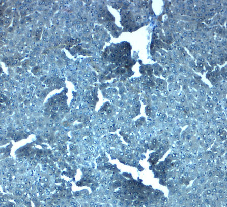 SLC38A4 Antibody in Immunohistochemistry (Paraffin) (IHC (P))