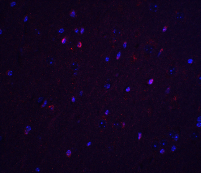 TNFAIP1 Antibody in Immunohistochemistry (Paraffin) (IHC (P))
