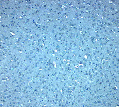 DIS3L2 Antibody in Immunohistochemistry (IHC)