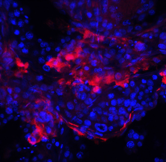 IQCF2 Antibody in Immunohistochemistry (IHC)