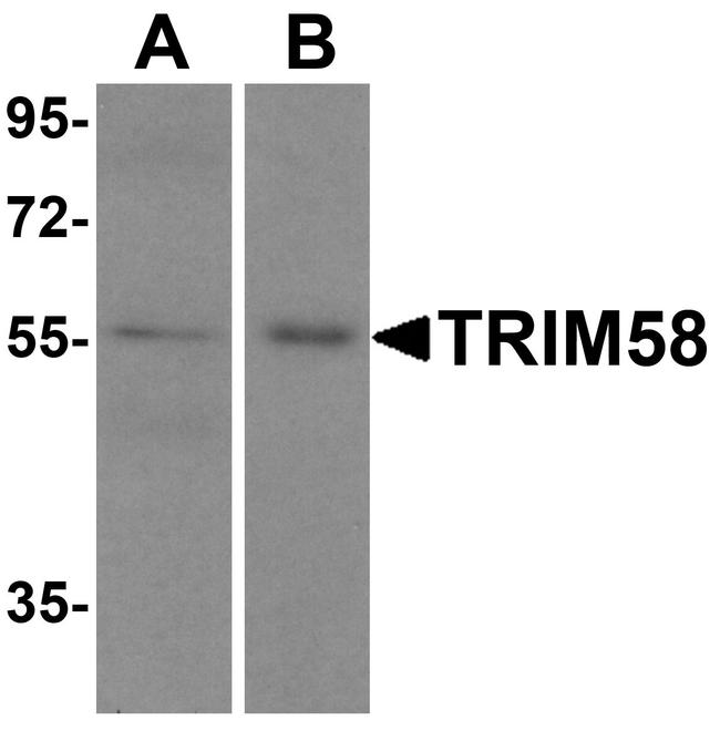 TRIM58 Antibody in Western Blot (WB)