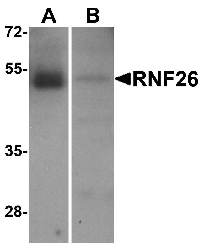 RNF26 Antibody in Western Blot (WB)