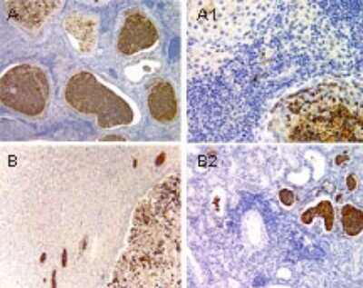 NCOA6 Antibody in Immunohistochemistry (Paraffin) (IHC (P))