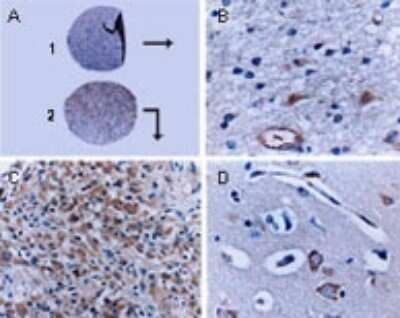 BFAR Antibody in Immunohistochemistry (Paraffin) (IHC (P))