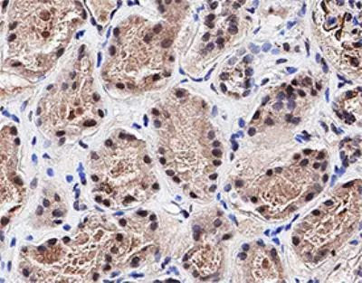 PTPN13 Antibody in Immunohistochemistry (Paraffin) (IHC (P))