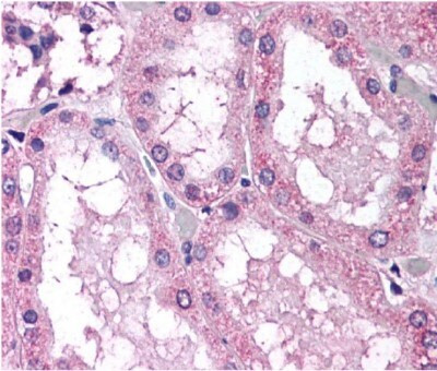 NOX4 Antibody in Immunohistochemistry (Paraffin) (IHC (P))