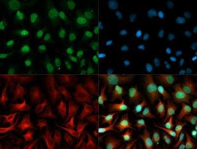 S100A12 Antibody in Immunocytochemistry (ICC/IF)