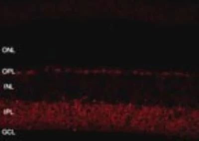 SHANK1 Antibody in Immunohistochemistry (Paraffin) (IHC (P))