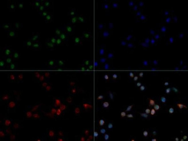 PRAME Antibody in Immunocytochemistry (ICC/IF)