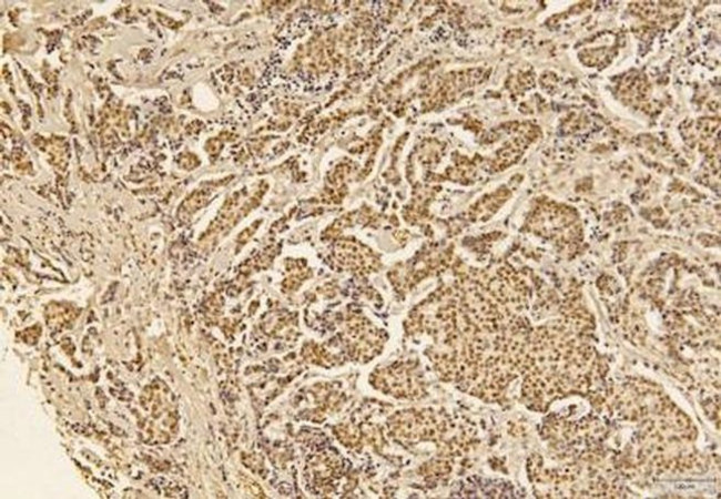 SGOL1 Antibody in Immunohistochemistry (Paraffin) (IHC (P))