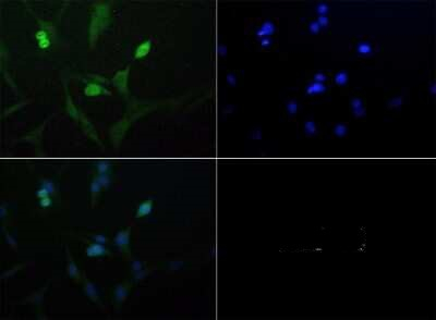 LAMTOR2 Antibody in Immunocytochemistry (ICC/IF)