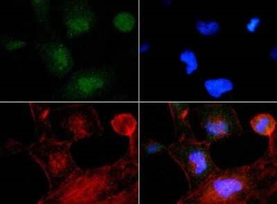 TP53INP2 Antibody in Immunocytochemistry (ICC/IF)