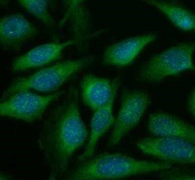 ATF6 Antibody in Immunocytochemistry (ICC/IF)