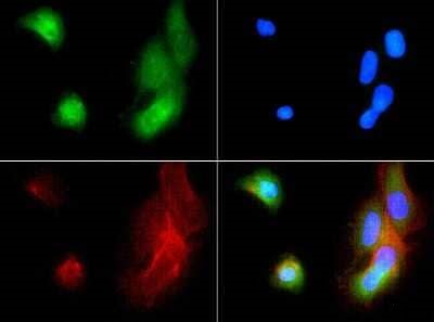 ABCB5 Antibody in Immunocytochemistry (ICC/IF)