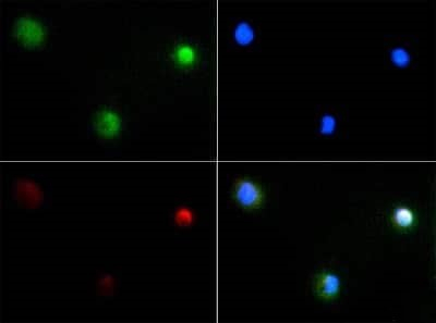 PIEZO2 Antibody in Immunocytochemistry (ICC/IF)