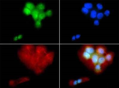 PIEZO2 Antibody in Immunocytochemistry (ICC/IF)