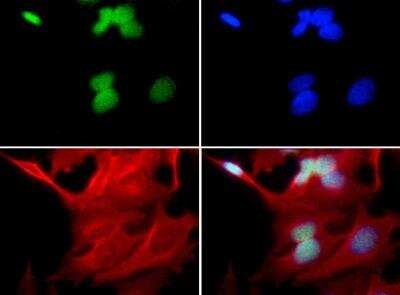 UBE2E1 Antibody in Immunocytochemistry (ICC/IF)