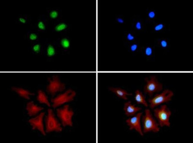 AKAP8L Antibody in Immunocytochemistry (ICC/IF)