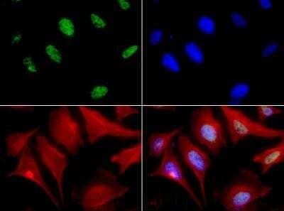 MBD4 Antibody in Immunocytochemistry (ICC/IF)