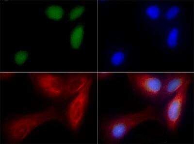 ZNF521 Antibody in Immunocytochemistry (ICC/IF)
