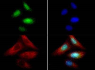 ZNF521 Antibody in Immunocytochemistry (ICC/IF)