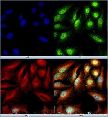 SETX Antibody in Immunocytochemistry (ICC/IF)